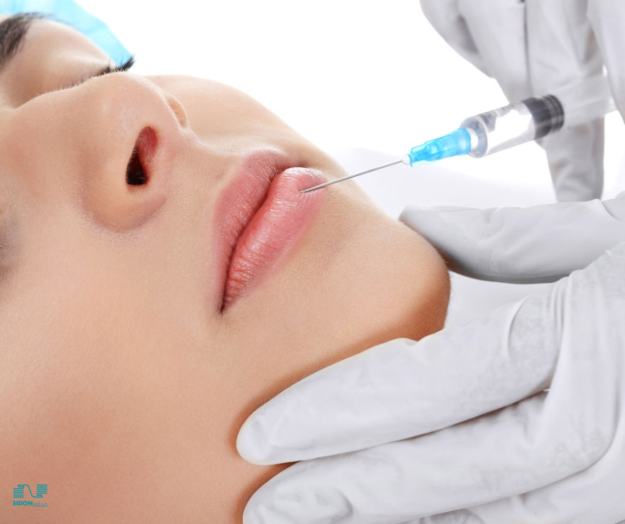 filler acido ialuronico filler acido ialuronico