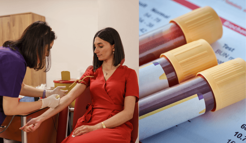 ragazza sottoposta ad analisi del sangue per rilevare la sindrome da stanchezza cronica