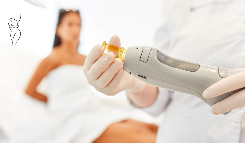 laser frazionato per lifting intimo